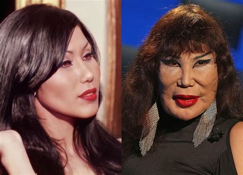 lyn may before|Lyn Mays Botched Plastic Surgeries Serve As A Stark。